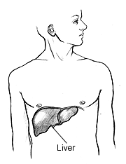 psoriasis medicartion causes liver disease