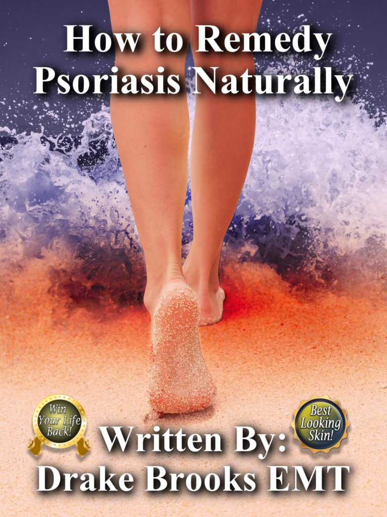 Salt Water Pools vs Chlorine Pools Psoriasis Sensitivity Review How